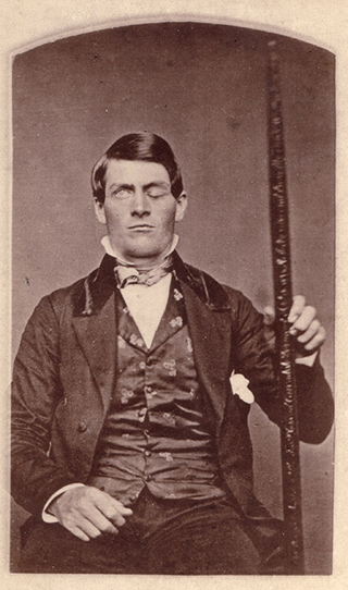 A portrait of Phineas Gage holding the tamping iron that injured him. Image: Phyllis Gage Hartley/Creative Commons.